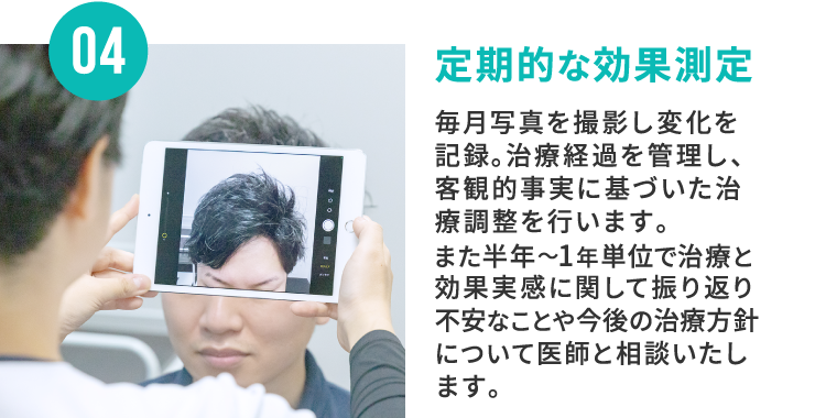 04 定期的な効果測定 毎月写真を撮影し変化を記録。治療経過を管理し、客観的事実に基づいた治療調整を行います。また半年〜1年単位で治療と効果実感に関して振り返り不安なことや今後の治療方針について医師と相談いたします。