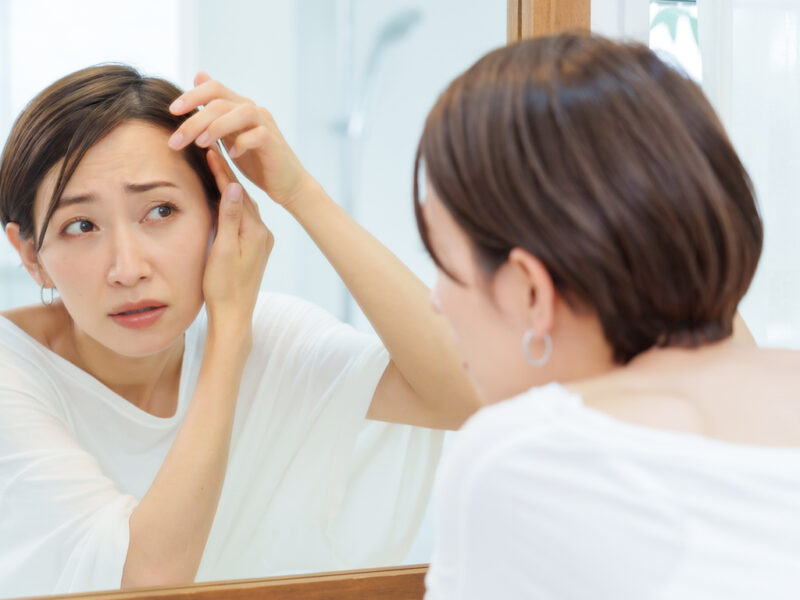 女性の薄毛治療・FAGA治療は保険適用になる？