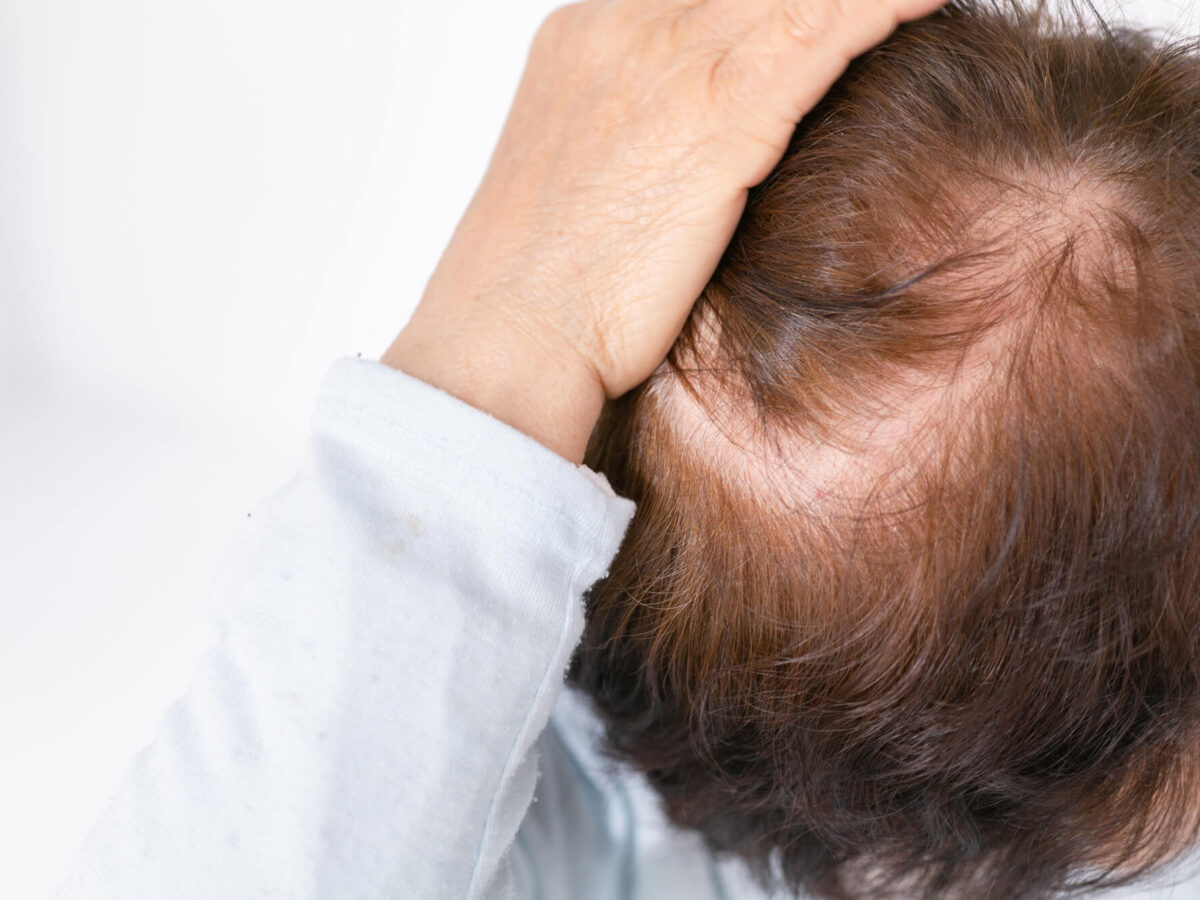 AGA治療はクリニック選びが大切！後悔しないためのポイントを徹底解説！