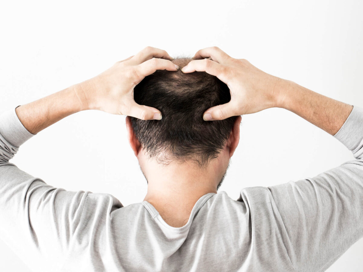 薄毛治療 皮膚科とAGA専門クリニックで効果に差はあるのか？それぞれ特徴を解説